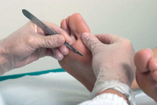 Valutazione Biomeccanica - Podos dott. Giacomo Sella Podologo